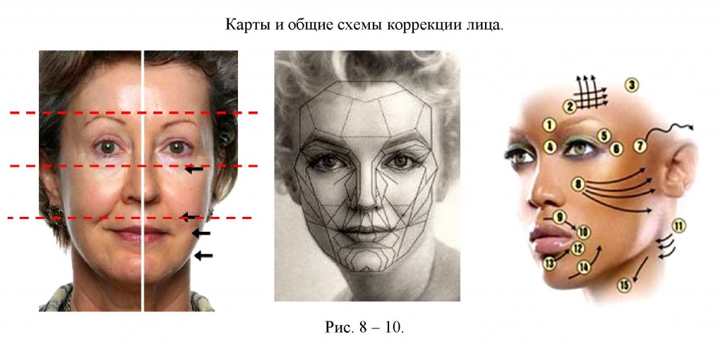 Точечная коррекция фото. Схема безопасных разрезов на лице. Операции на лице золотое сечение. Птоз лица схема.