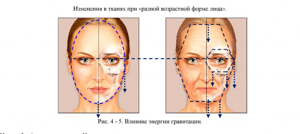 Тейпирование межбровной морщины схема