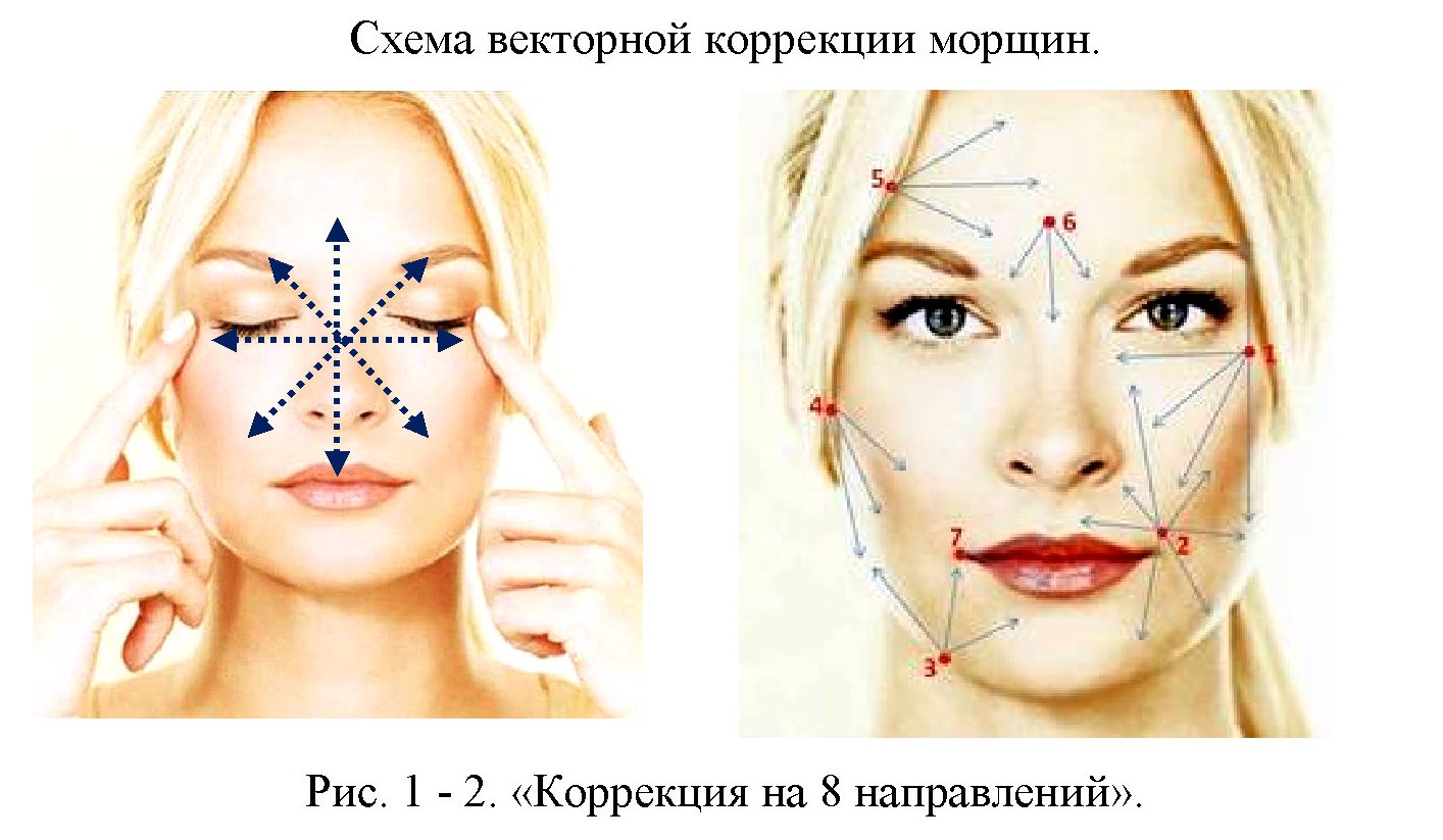 Тейпирование межбровной морщины схема