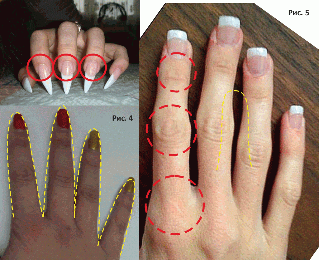 Формы ногтей для пальцев