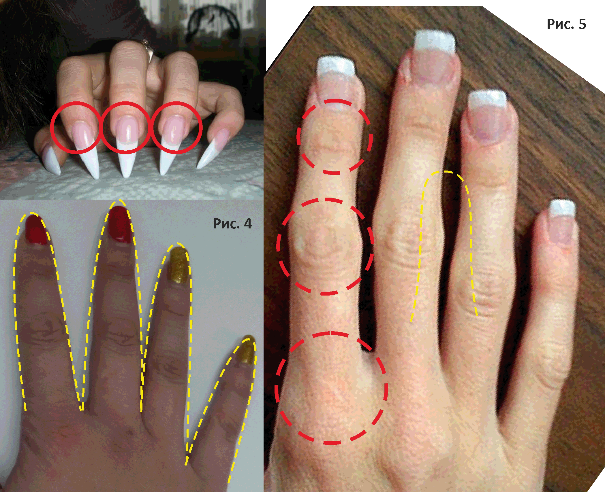 Можно ли изготовить. Форма пальцев. Разные формы пальцев. Форма пальцев на руках. Форма ногтей для пальцев.