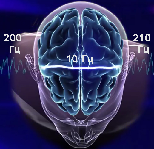 Мозг альфа бета. Волны головного мозга. Электромагнитные волны мозга. Альфа ритмы головного мозга. Частота излучения мозга.